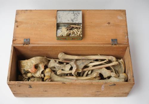 Anatomy - A partial human skeleton