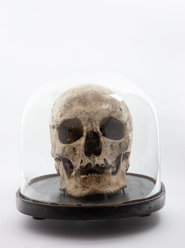 A human skull in Victorian glass dome